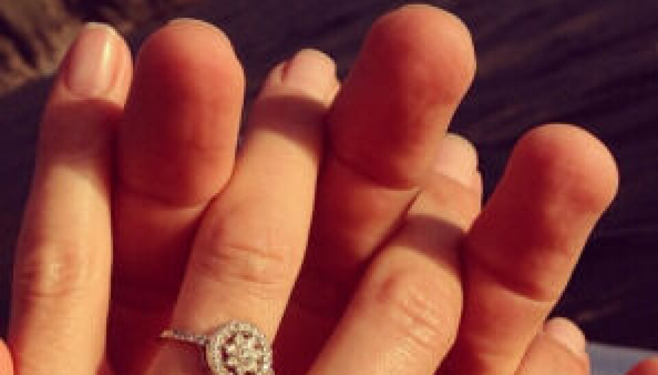 Sådan ser ringen ud, som pryder Andreas smukke finger. (Foto: Instagram/andrearudolph)