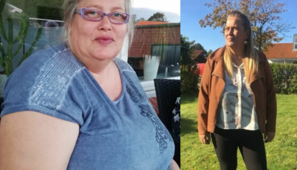 Jane før og efter det imponerende vægttab på 35 kg (Foto: Privat).