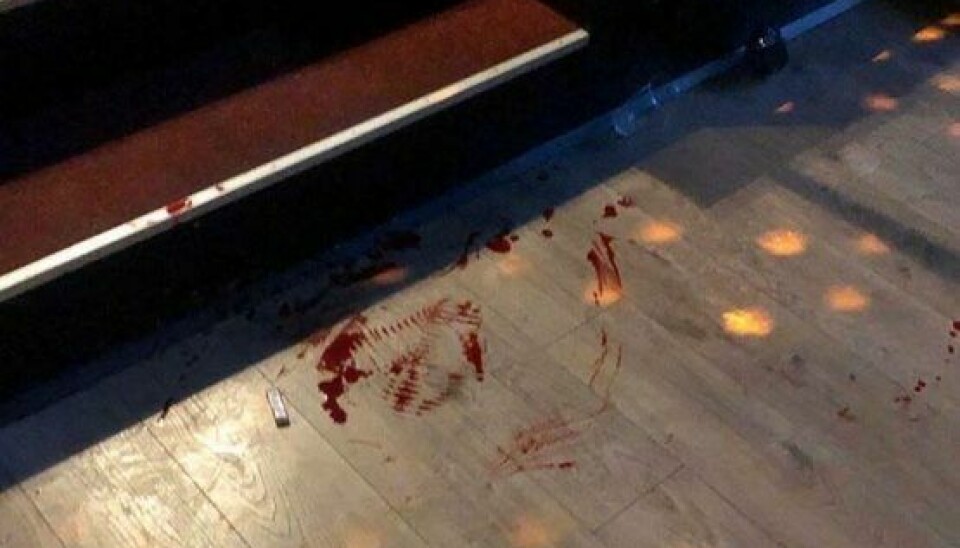 Teitur efterlod sig et blodigt diskoteksgulv , da han faldt ned af denne trappe og landede på et glasskår (Foto: Privat)