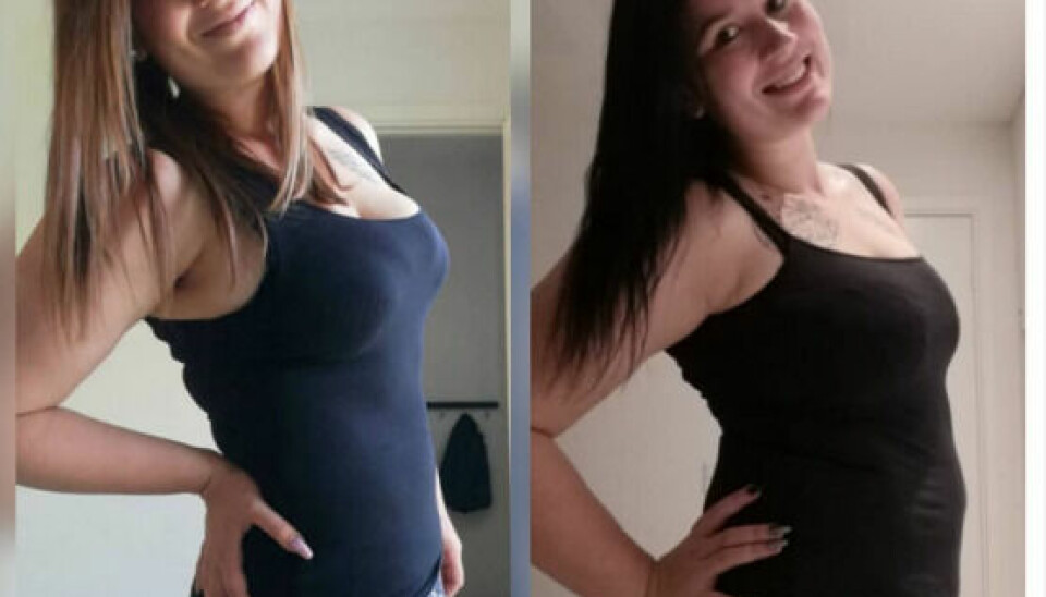Billedet til venstre viser, hvordan Luna Munk så ud for et år siden. Billedet til højre er Luna Munk i dag. Foto: Privat