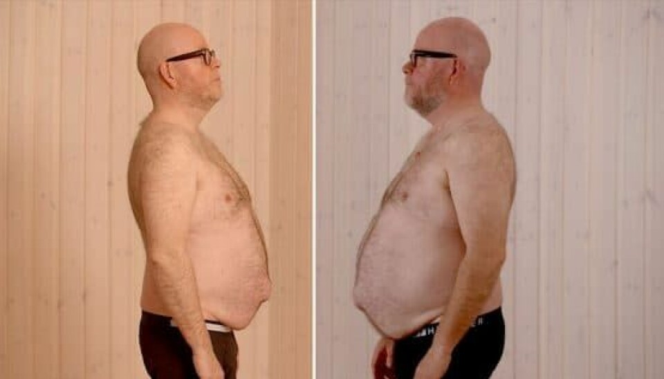 Claus Holm i dag og før, hvor han var 7,9 kg tungere (Foto: Mads Castillo/TV2 og Henrik Klock/TV2)